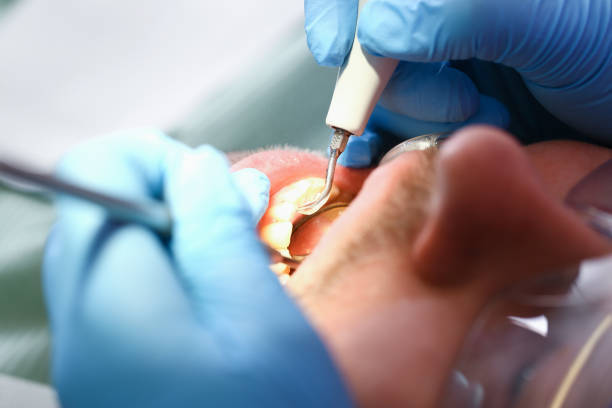 Best Emergency Cosmetic Dentistry in Frankton, IN