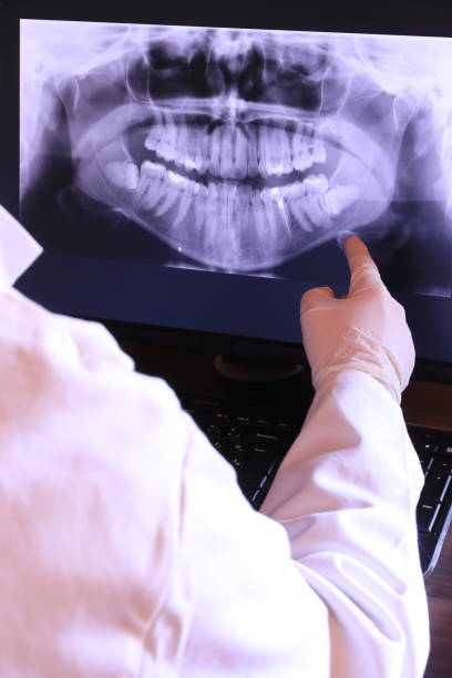 Best Emergency Dentist for Lost Fillings or Crowns in Frankton, IN